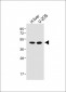 METTL4 Antibody (C-term)